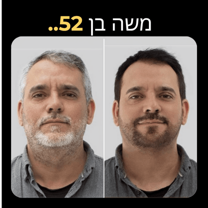 ™KUROKAMI שמפו